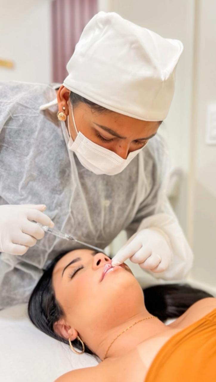 Preenchimento Labial - Dra. Leidiane Costa